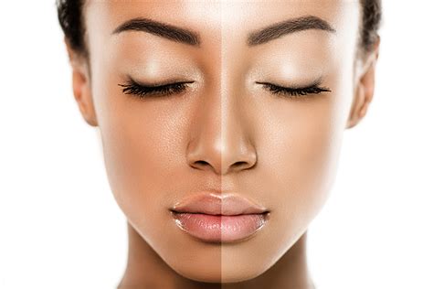 Skin brightening - AFAA