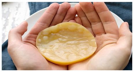 Tìm hiểu về SCOBY của trà Kombucha | BvNTP