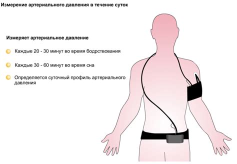 Суточный мониторинг артериального давления