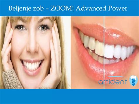 Commuters complain about the lack of seating at lauenburg zob 3