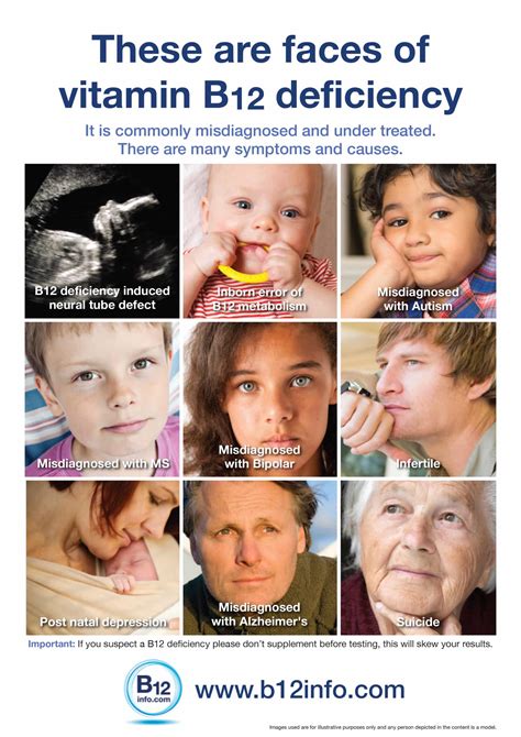 Vitamin B12 Deficiency Symptoms Face at Tayla Thornton blog