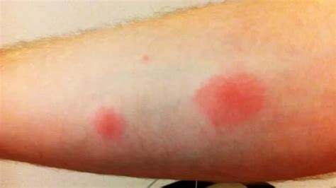 Do Cockroaches Bite? You Need to Know About These Pests