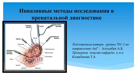 Инвазивные методы исследования в пренатальной диагностике - презентация ...