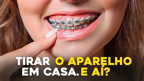 O Dentista Pode Cobrar Para Tirar O Aparelho - TIRAR O APARELHO DENTARIO EM CASA. E aí? - YouTube