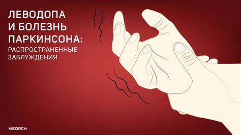 Леводопа и болезнь Паркинсона: распространенные заблуждения