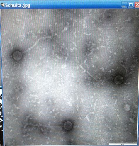 actinobacteriophage  phage brutar