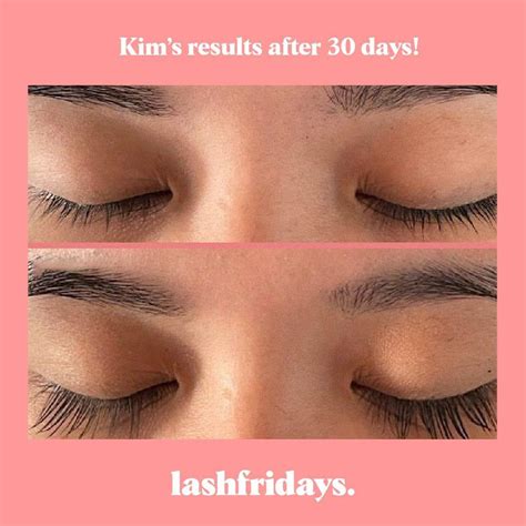 EYELASH SERUM - LashFridays - Sanctum Medical