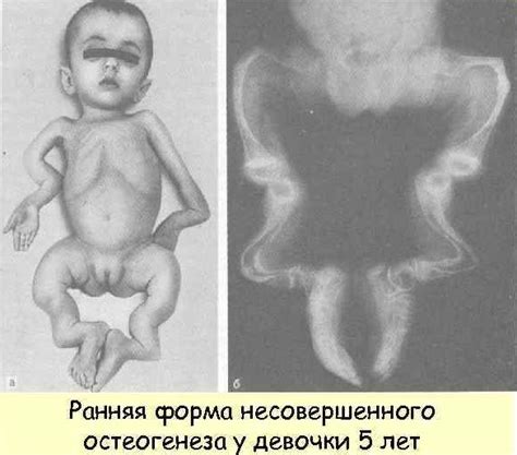 Кардиосклероз: что это такое, как его как лечить, симптомы