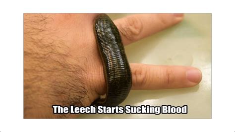 leech feeding youtube