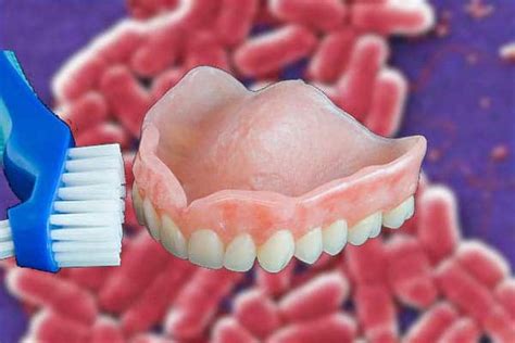 cleaning dentures