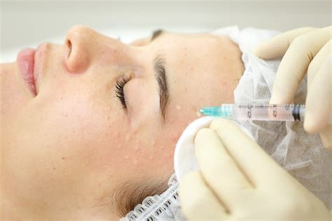 Мезотерапия лица в Москве. Выгодные цены в клинике GMTClinic