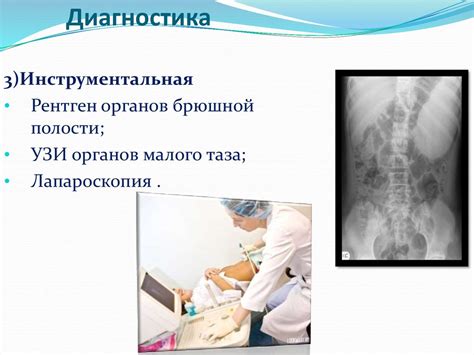 Воспалительные заболевания внутренних женских половых органов - online ...