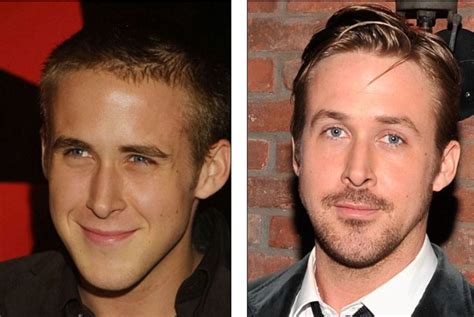 Has Ryan Gosling Received a Nose Job? Then and Now Pictures Examined!