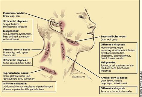 Възпалителни заболявания на лимфните възли | www.dentalsurgeon.eu