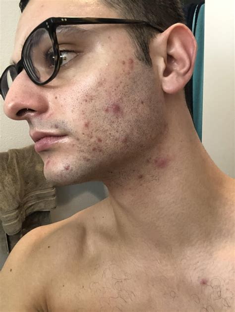 [Routine Help] M, 22 took accurate a few years ago. Still trying to ...