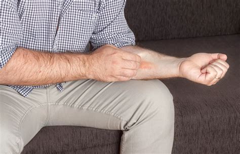 Laundry Detergent Cause Skin Rash at Jonathan Stiefel blog