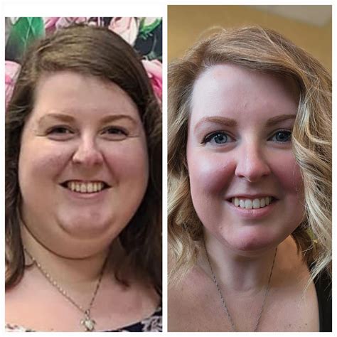 11 months SW:280 HW:296 CW:199 F5'6" with PCOS : r/Ozempic