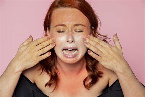 how to get rid of sunburn fast 7