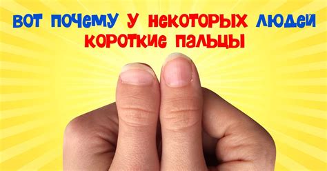 Короткий большой палец на руке