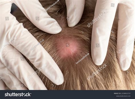 Doctor Examines Bump On Head Close Stock Photo 2158912737 | Shutterstock