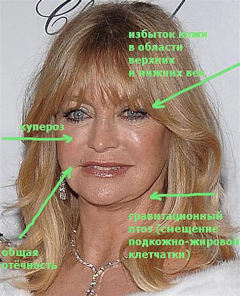 ТИПЫ СТАРЕНИЯ