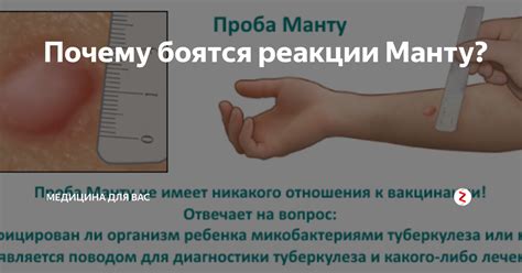 Почему ребенку нельзя мочить манту и что будет, если это сделать, через ...