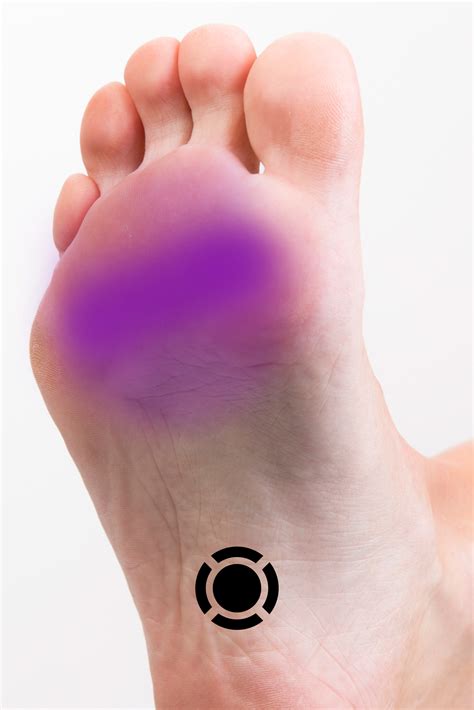 Flexor Digitorum Brevis (Foot) Summary – Komizo Diagnostics