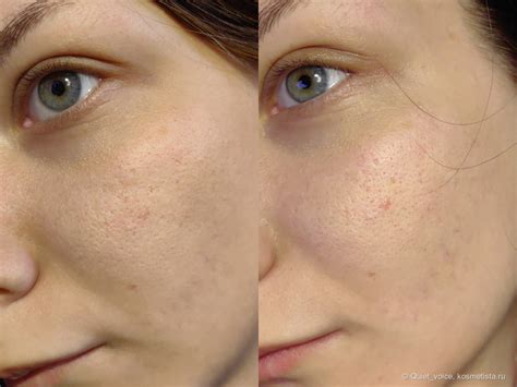 Сыворотка Moccoty Lifting-serum Coffee bean oil | Отзывы покупателей ...
