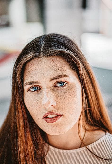 Pimples On Face HD phone wallpaper | Pxfuel