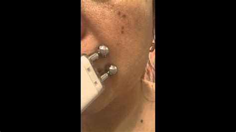Действие Bio Wave Gezatone m920 - YouTube