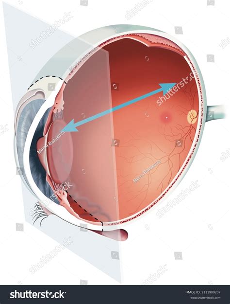 Structure Human Eye Anatomy Poster Stock Illustration 2111909207 ...