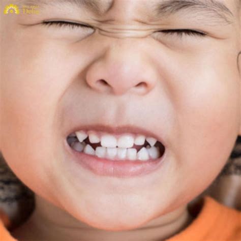 ngu nghien rang la bi gi phuong phap  gian tri ngu nghien rang