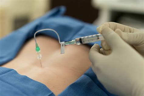 Epidural Injections | Nona Medical Arts - Injections for Neck and Back Pain