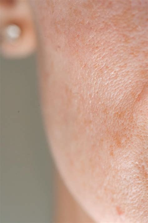 close  photo  human cheek  stock photo