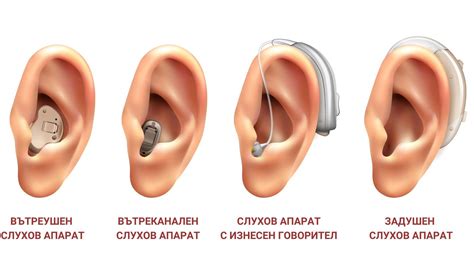 Шум в ушите: Симптоми | Причини | Лечение | Превенция