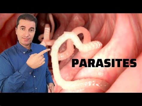 Kako ukloniti PARAZITE IZ TIJELA? - YouTube