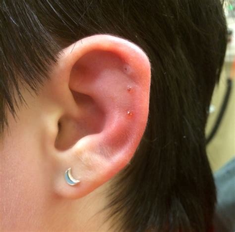 how to care for infected cartilage piercing