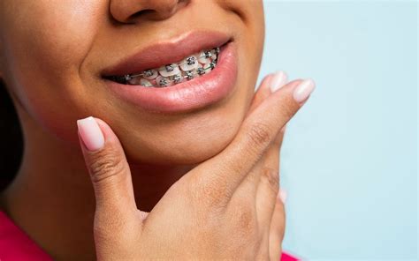 Improve Jaw Alignment with Orthodontic Treatment