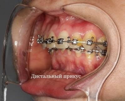 Ортогнатическая хирургия — Face Surgery