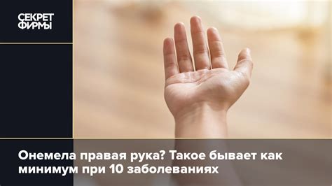 Немеет правая рука — причины: Жизнь — Секрет фирмы