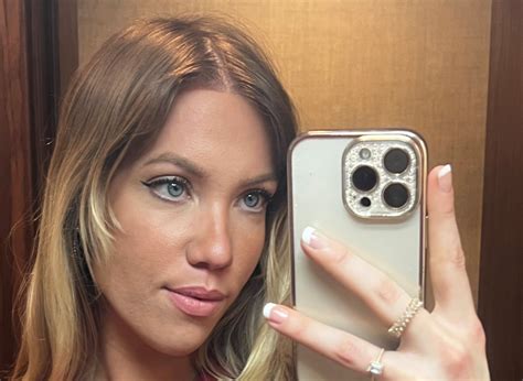 Woman who had hair transplant to cover 'big forehead' reveals results