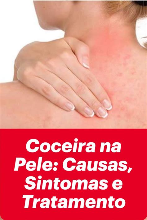 Dst Que Da Coceira No Corpo - Alergia No Corpo Com Coceira , Coceira no corpo à noite: causas e ...