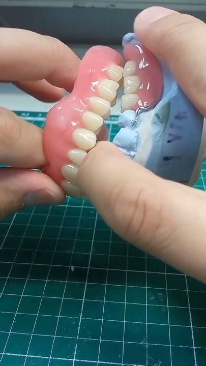 зубной протез акриловый ПСП чсп #dental - YouTube