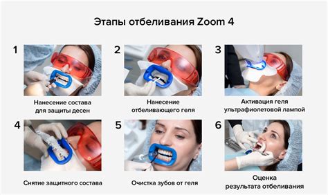 Аппаратное отбеливание Philips Zoom 4 | Эскомед - стоматологическая клиника