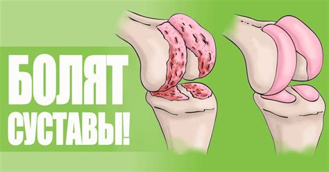 Боли в мышцах и суставах