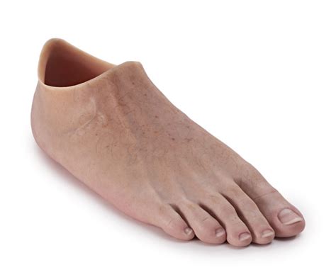 partial foot amputation atlantic prosthetic orthotic services