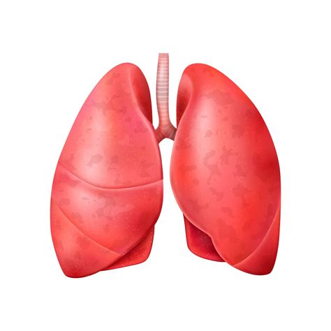 What Are the 14 Symptoms of Bronchiectasis? What Causes Bronchiectasis?