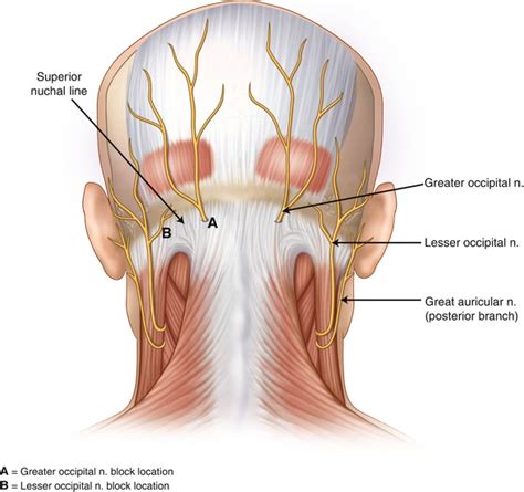 Back of head pain