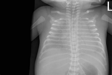 RadiologySpirit