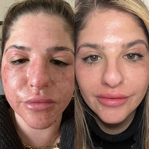 wear makeup   laser saubhaya makeup